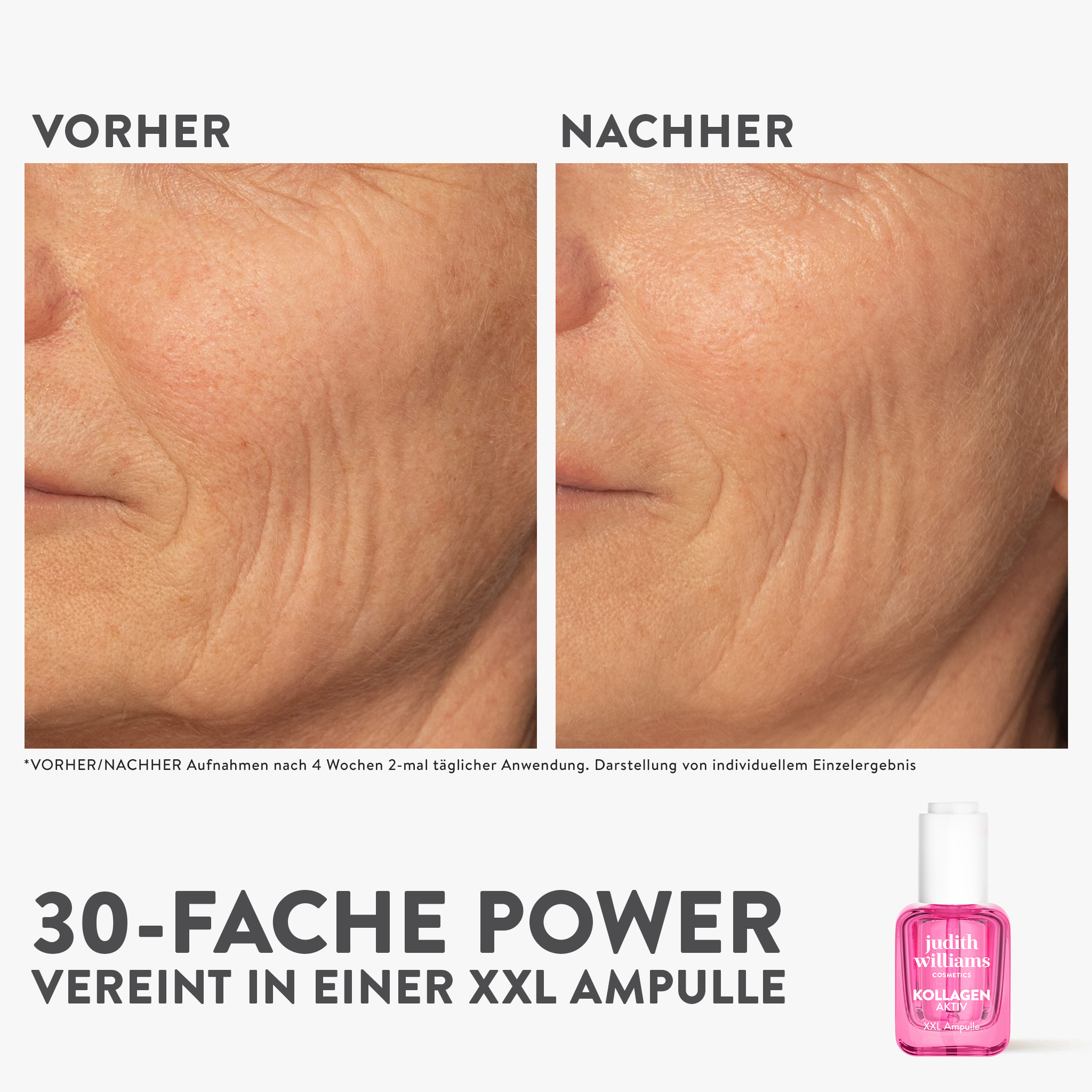 Ampullenkur | Kollagen Aktiv | XXL Ampulle | Judith Williams