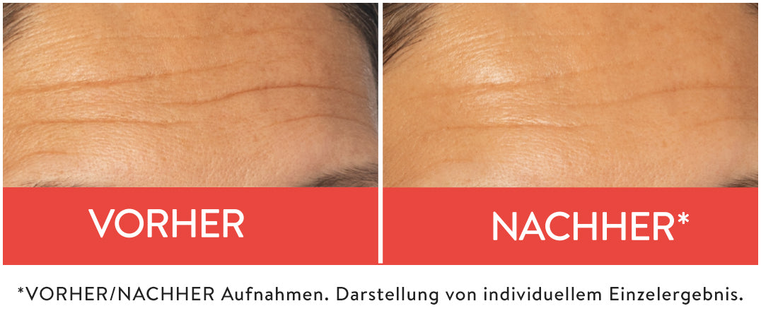 Gesichtskonzentrat | Peptide+ | Falten-Filler | Judith Williams