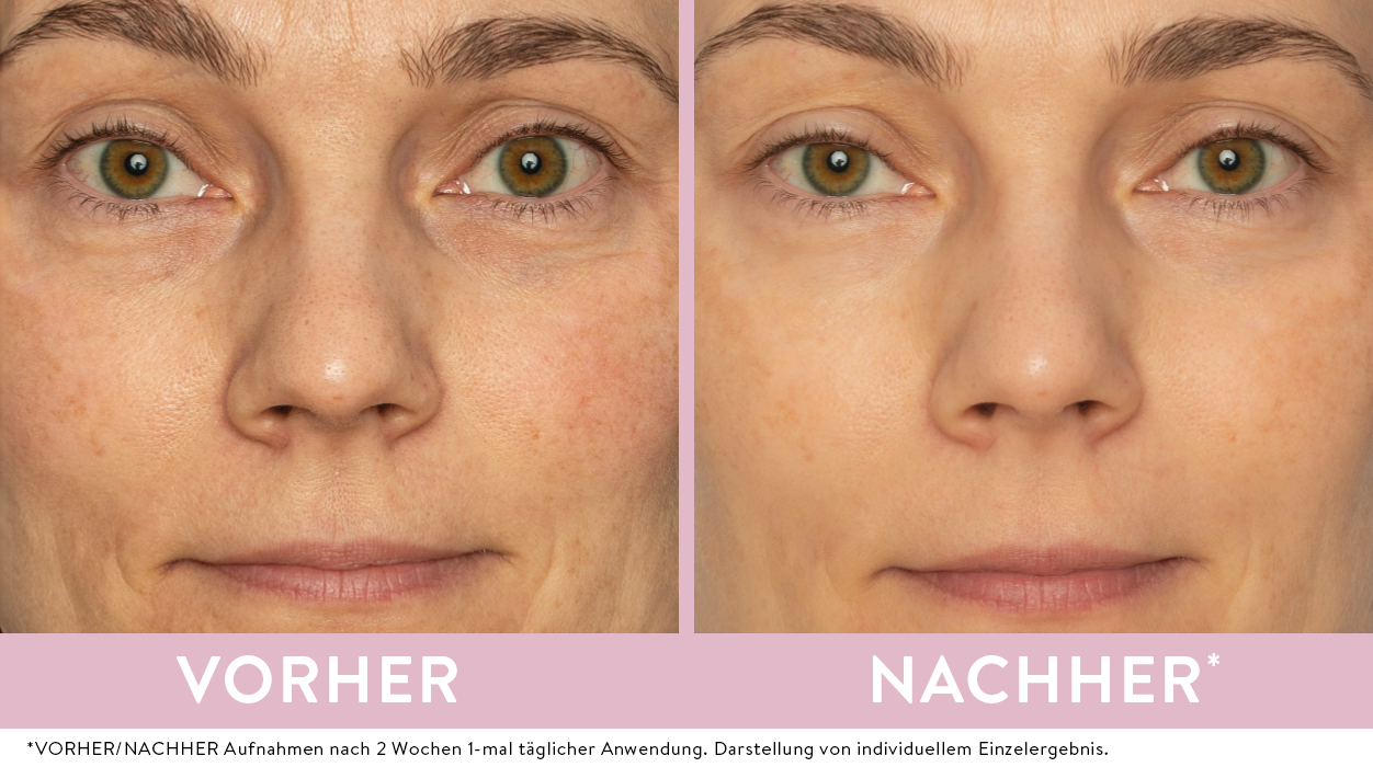 Bild von einem Model, das den Vorher-Nachher-Effekt vom Rose Gesichtsöl von Judith Williams Cosmetics zeigt.