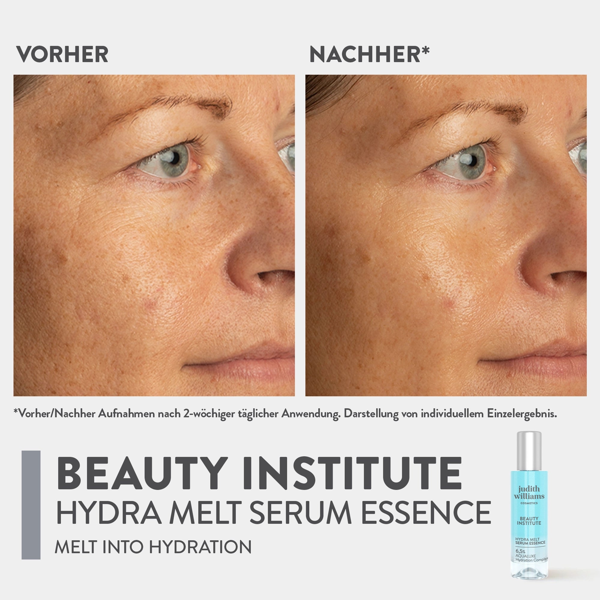 Gesichtsserum | Beauty Institute | Hydra Melt Serum Essence | Judith Williams