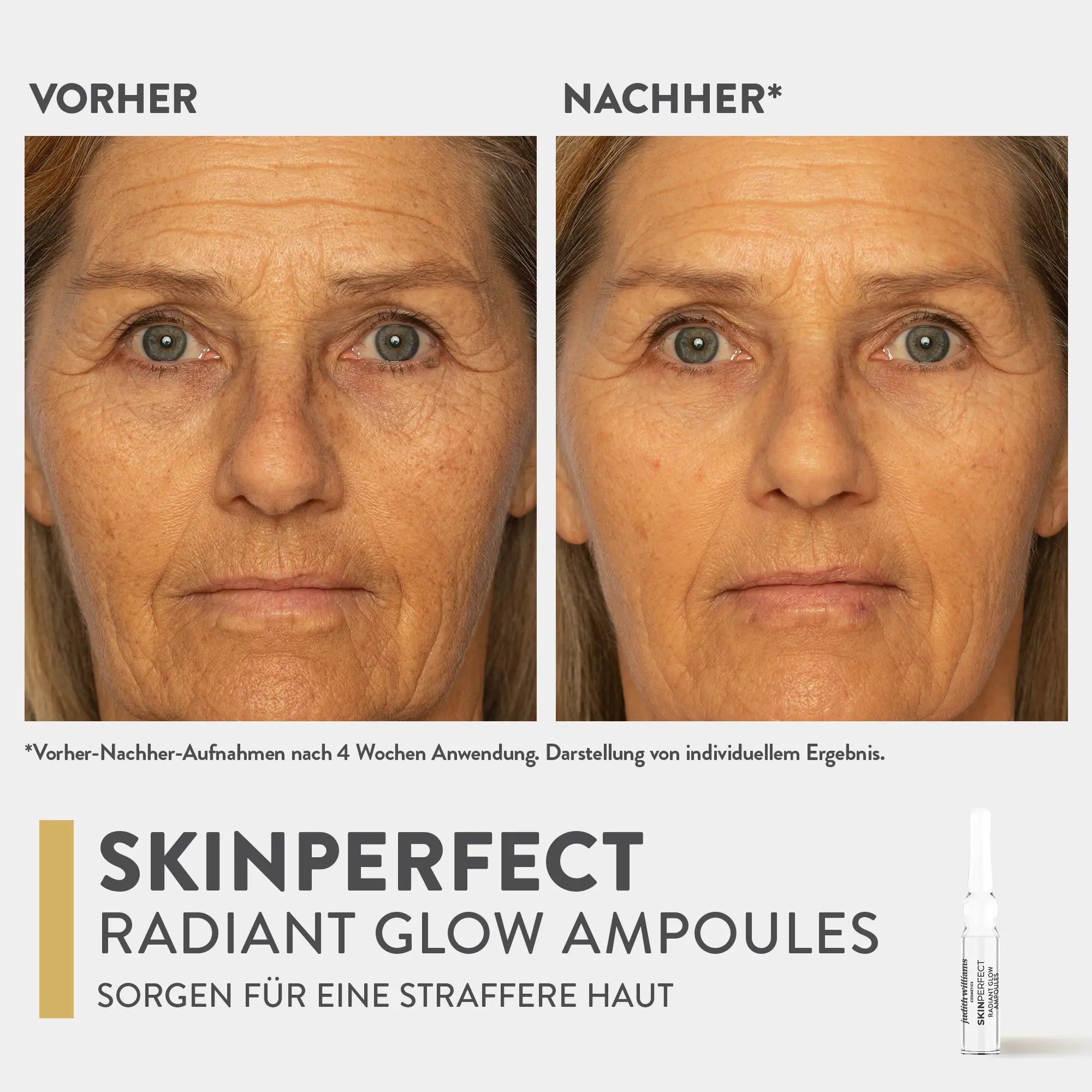 Ampullenkur | SkinPerfect | Radiant Glow Ampoules | Judith Williams