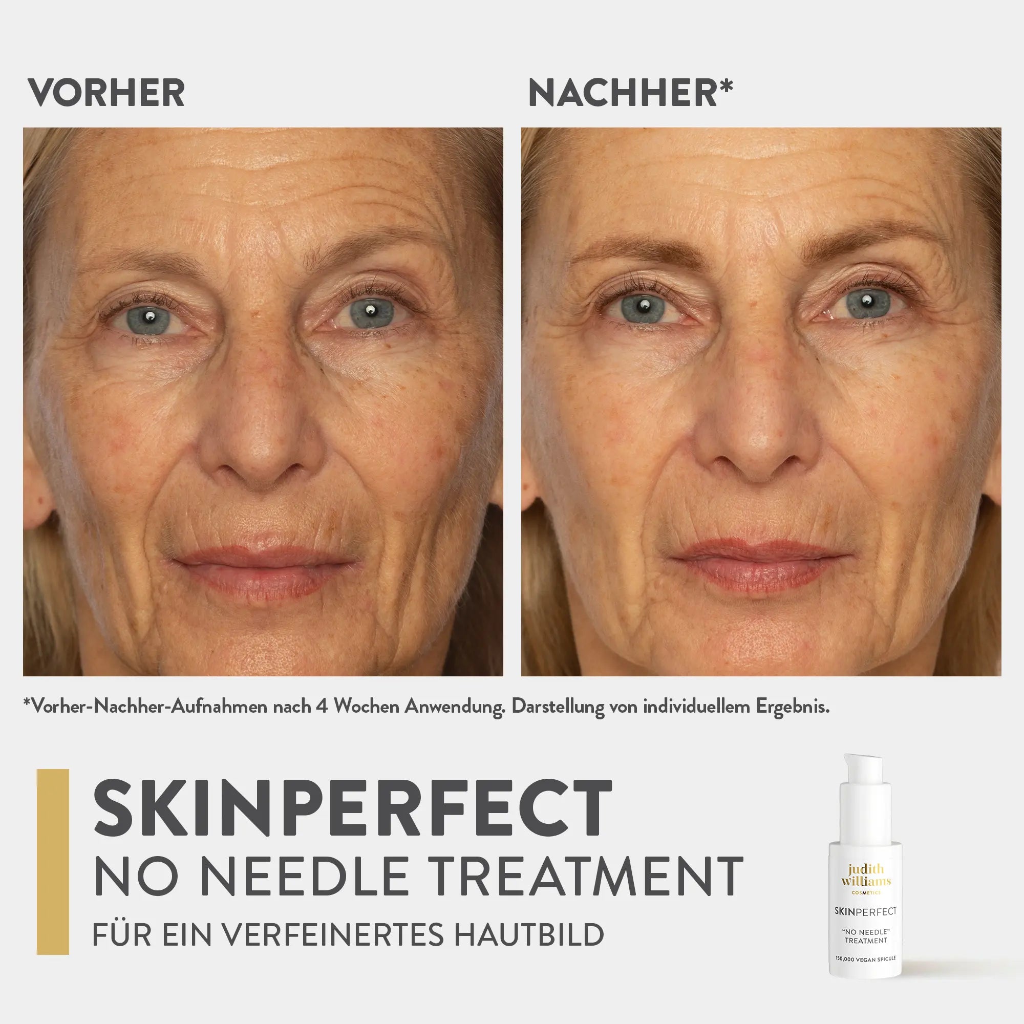 Gesichtskonzentrat | SkinPerfect | No Needle Treatment | Judith Williams