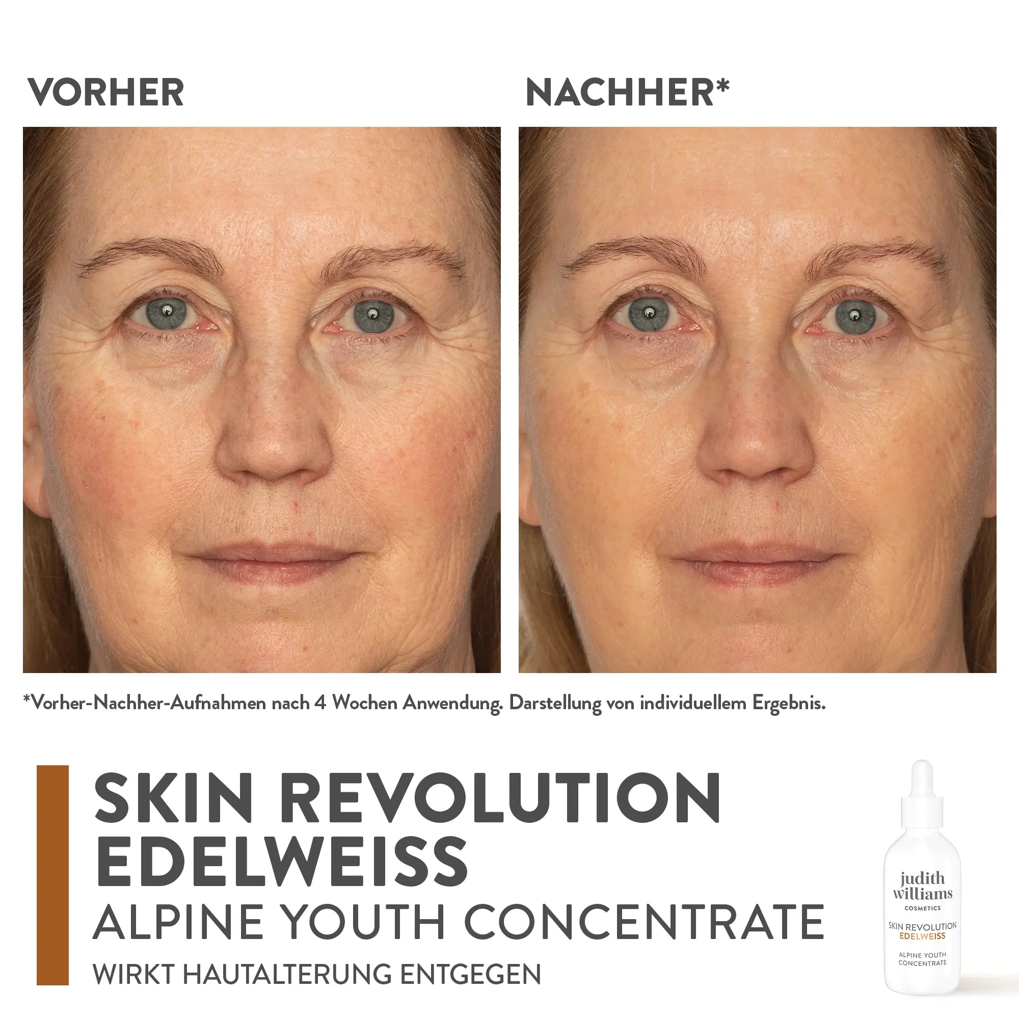 Gesichtskonzentrat | Skin Revolution Edelweiss | Alpine Youth Concentrate | Judith Williams