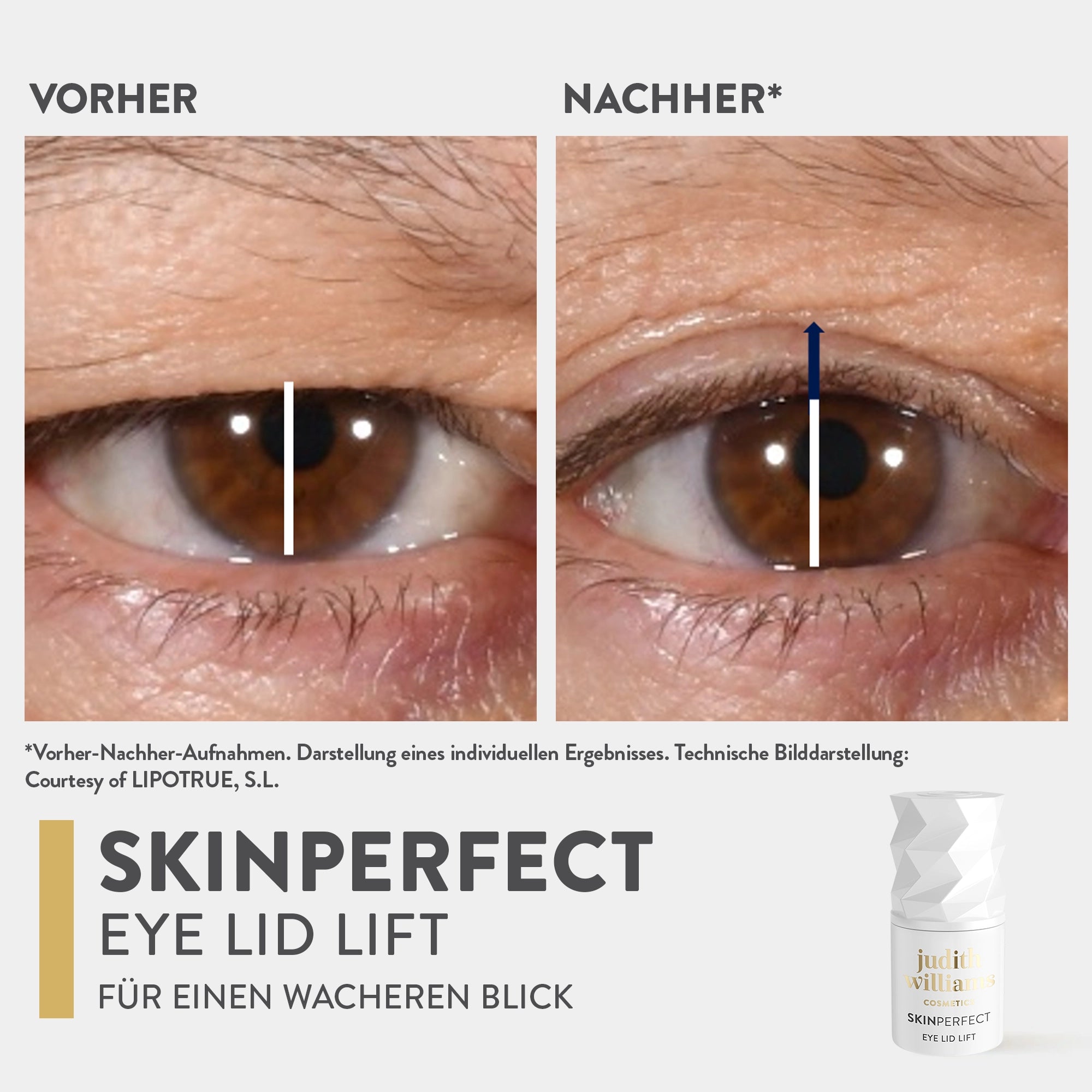 Augencreme | SkinPerfect | Eye Lid Lift | Judith Williams
