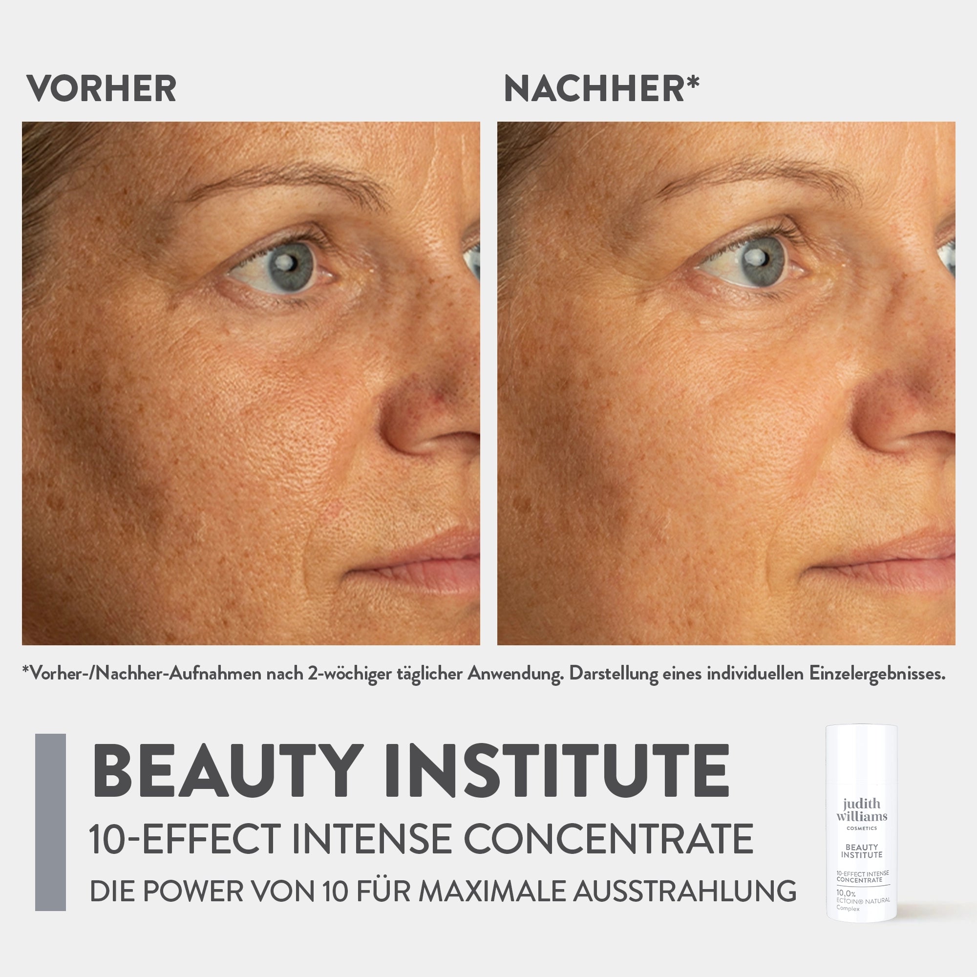 Gesichtskonzentrat | Beauty Institute | 10 Effect Intense Concentrate | Judith Williams