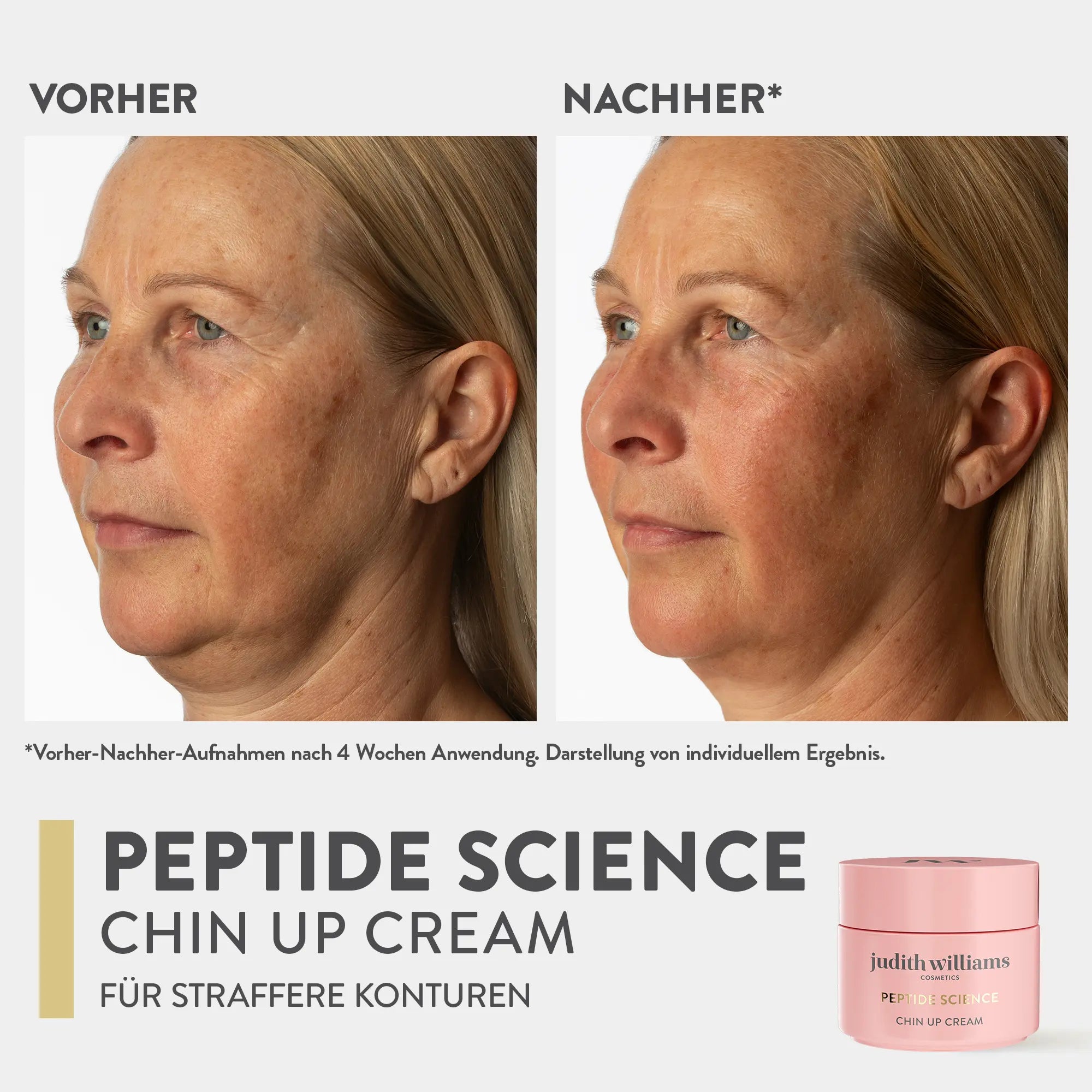 Hals und Dékolleté Creme | Peptide Science | Chin Up Cream Ring Of Youth | Judith Williams