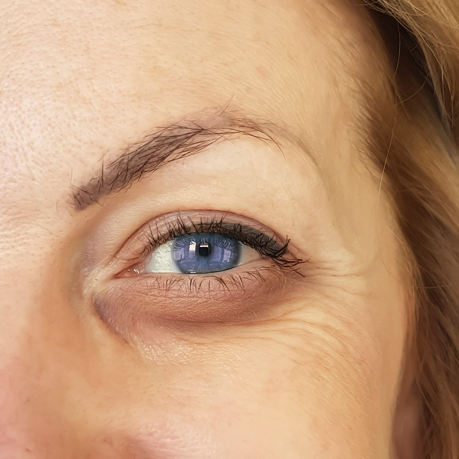 2. Augenringe adé – wacher Blick in Minuten