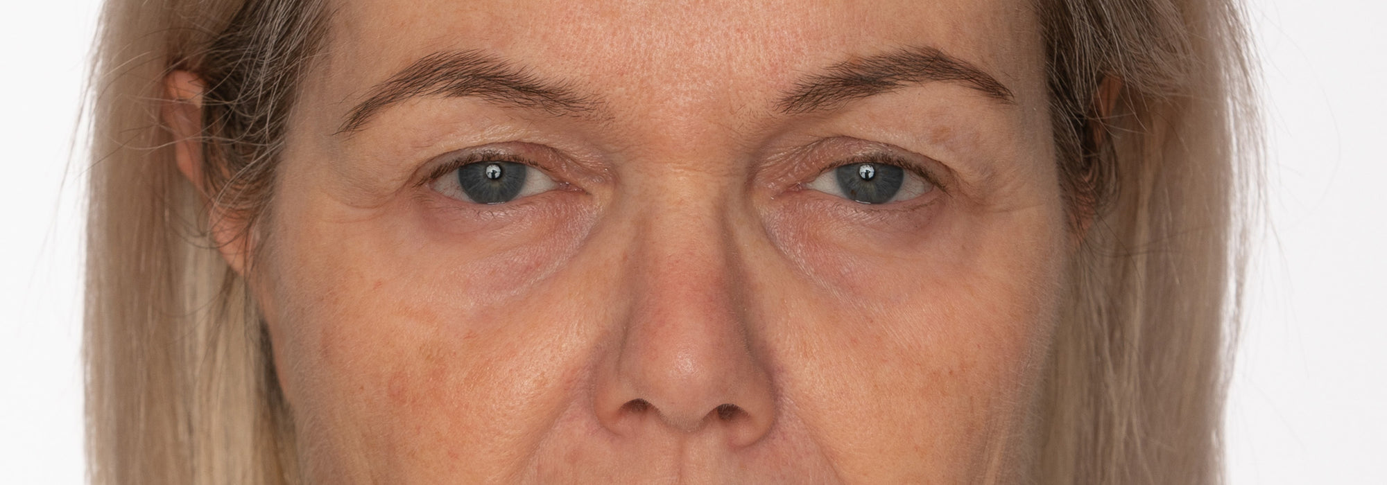 Augenpartie nach dem Auftragen der Hydrogel Eye Pads