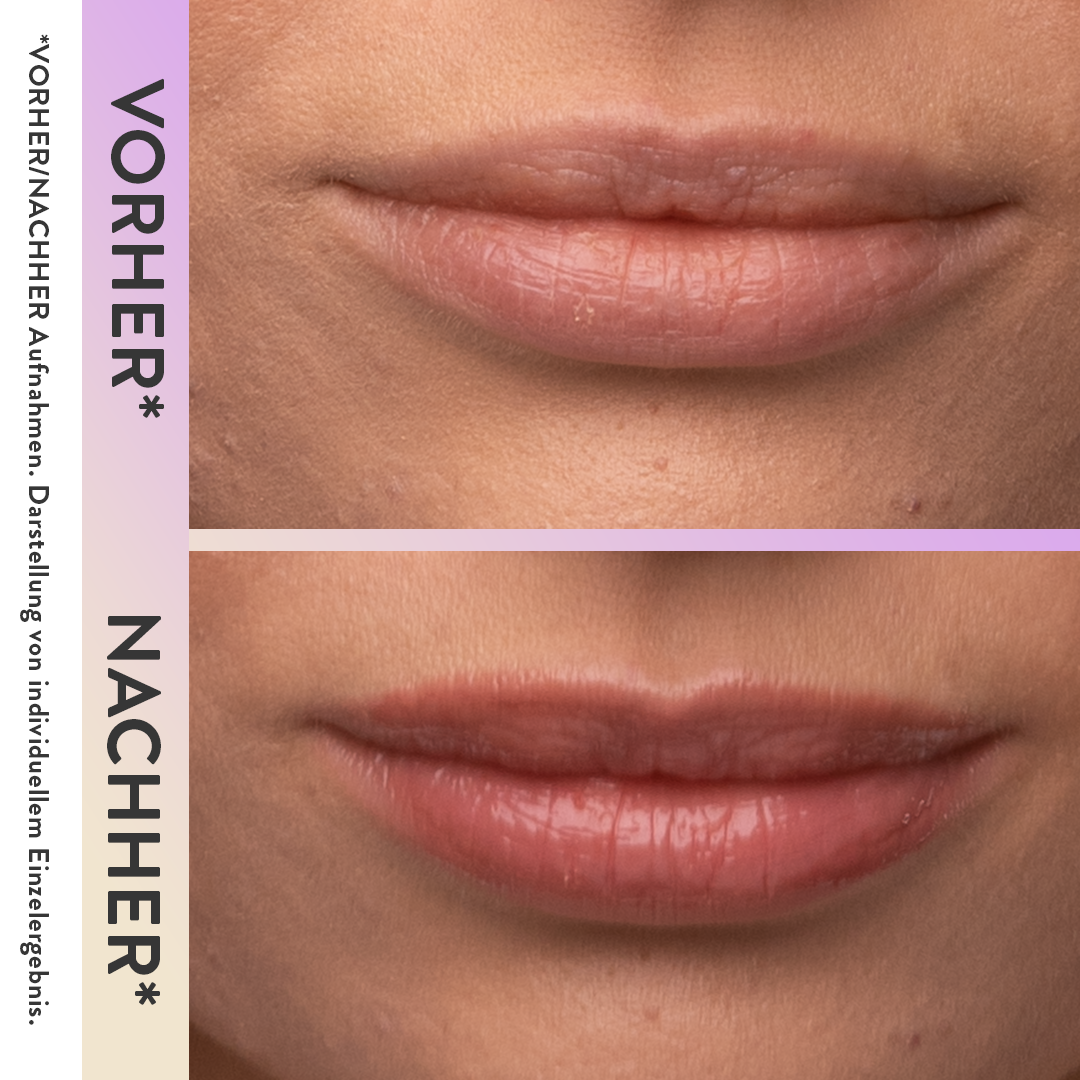 Lipgloss | Magic Wonder | Peptide Lip Boost | Judith Williams