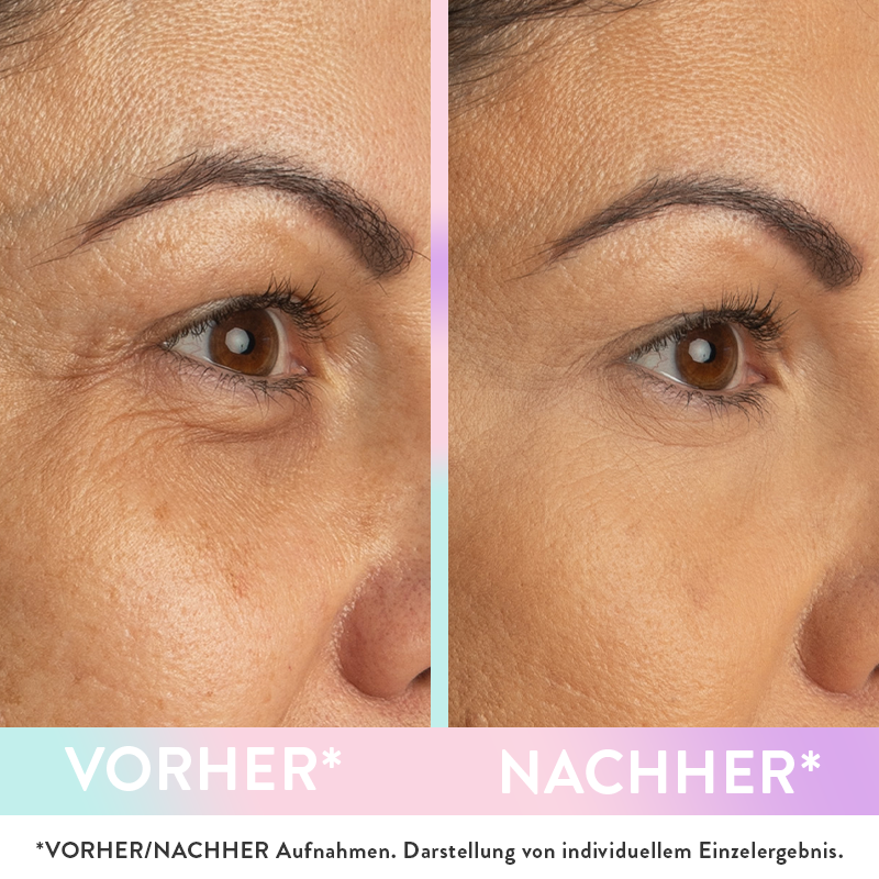 Concealer | Magic Wonder | Magic Wonder Eye Balm | Judith Williams