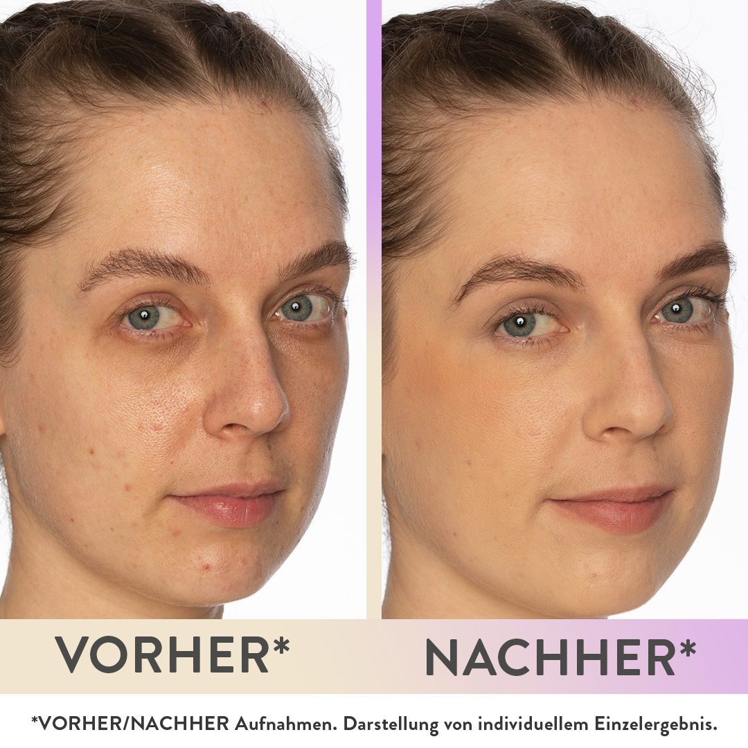 Concealer | Magic Wonder | Magic Wonder Eye Balm | Judith Williams