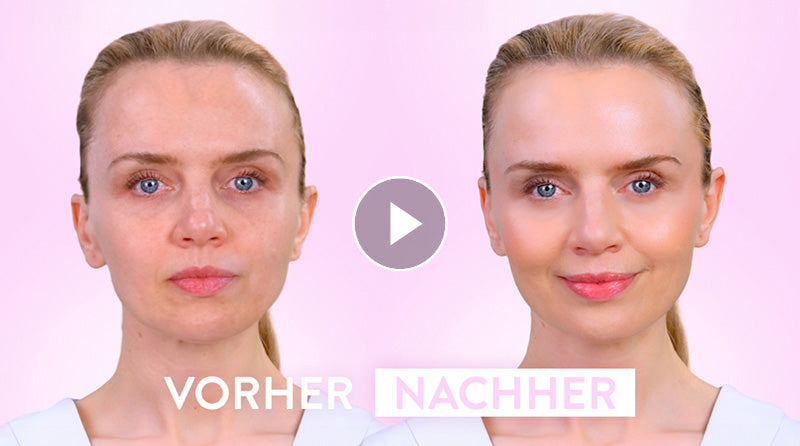 Vorher-Nachher-Bild Kollagen Aktiv
