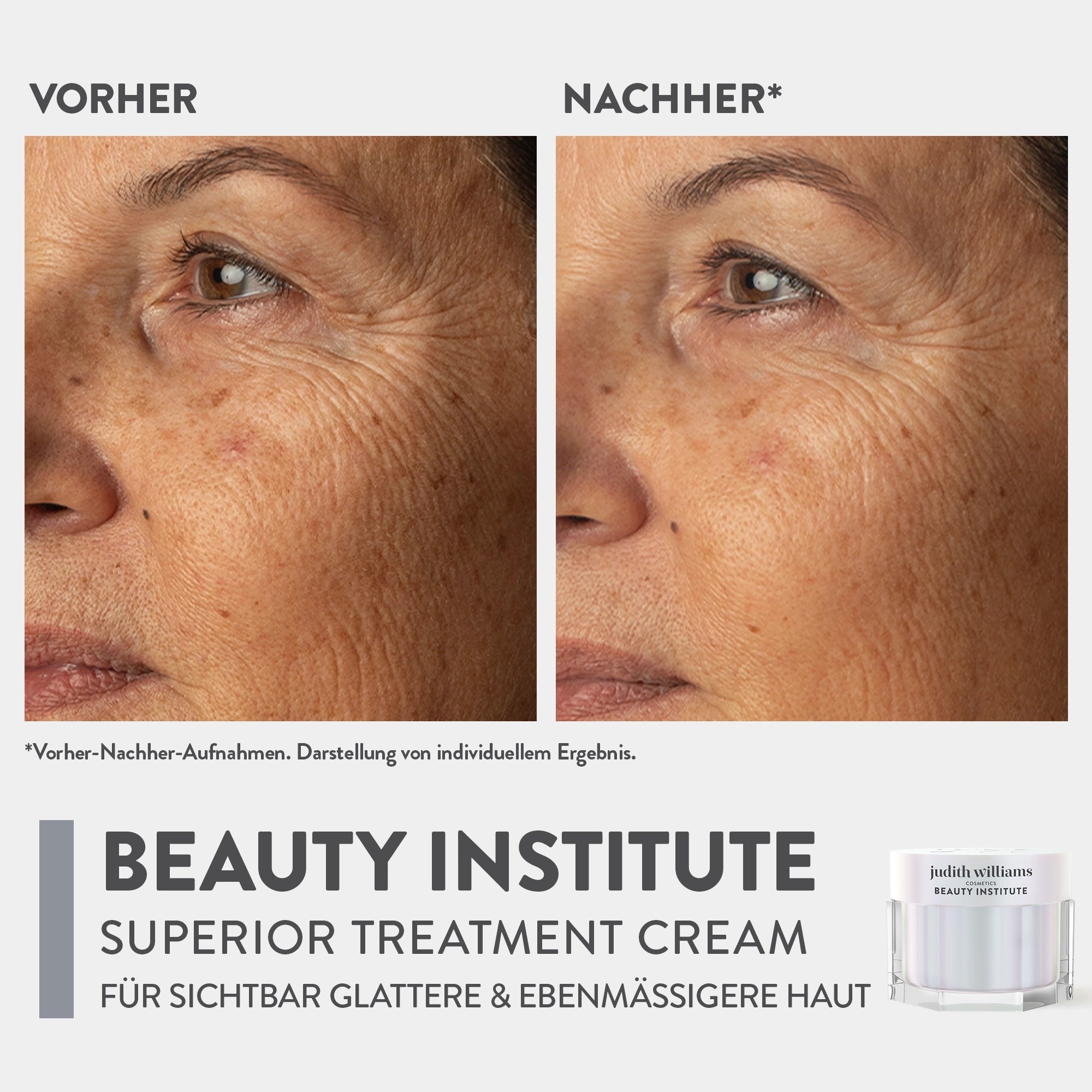 Gesichtscreme | Beauty Institute | Superior Treatment Cream | Judith Williams