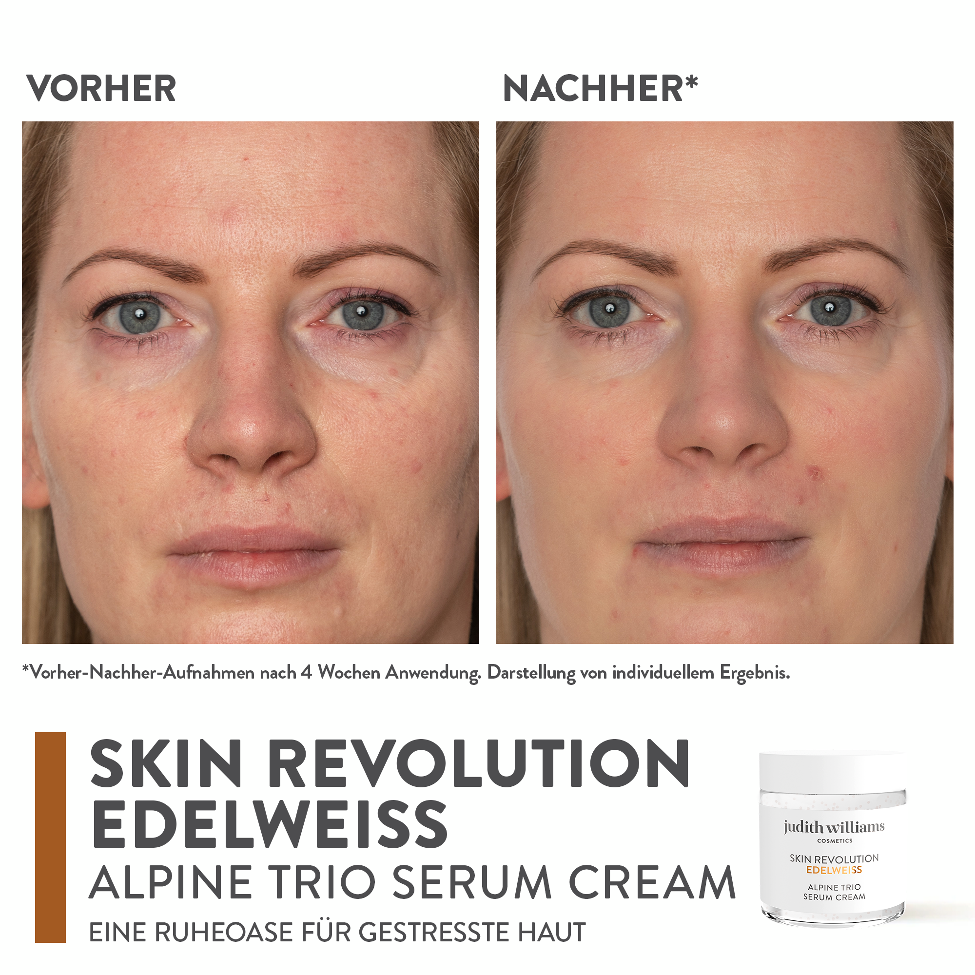 Gesichtscreme | Skin Revolution Edelweiss | Alpine Trio Serum Cream | Judith Williams