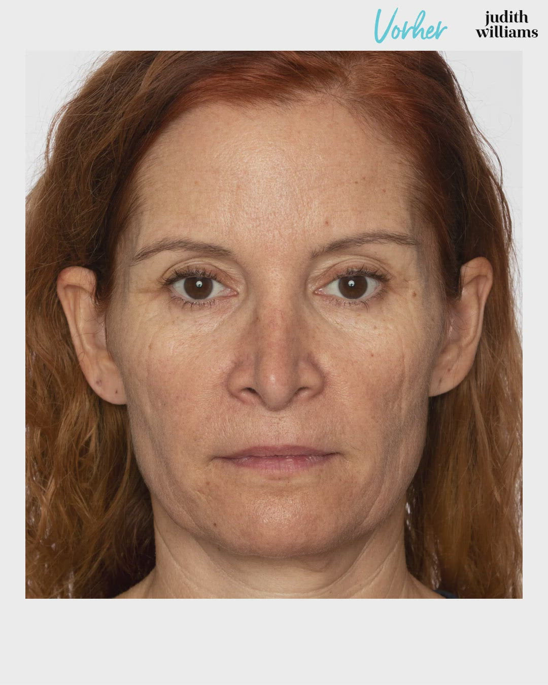 Hydrolyte Face Cream